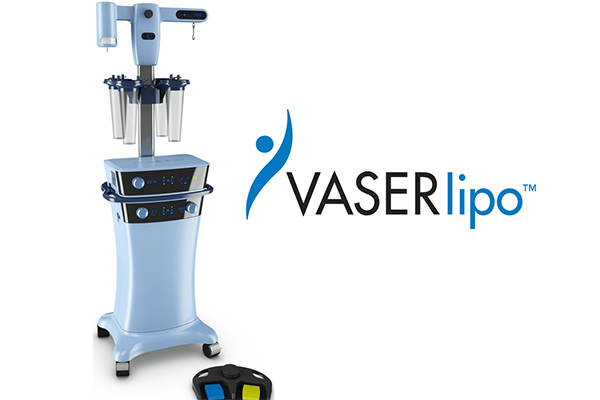 THE VASER LIPO ® SYSTEM
